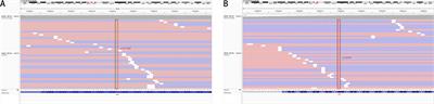 EGFR p.V774M/p.L833V compound mutations in lung adenocarcinoma responded well to almonertinib: a case report